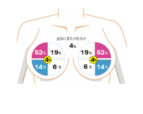 しこりができやすい場所